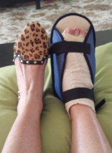 My repaired foot and its stylish friend